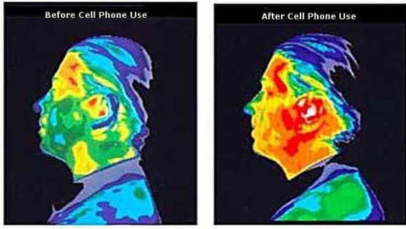 Cell Phone Radiation Cell phone radiation EMF Cancer Tumor